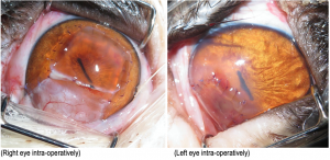 Melon Guo Ophthalmology case study