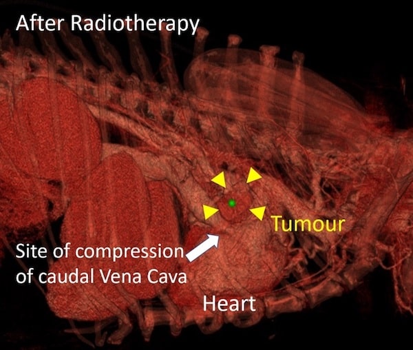 Dexter's rare heart tumour after radiotherapy treatment