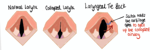 Surgery to correct laryngeal paralysis in dogs