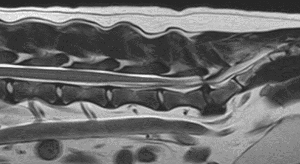 MR image of a dog’s lumbosacral area depicting a disc protrusion and ventral spondylosis at L7-S1.