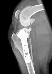 tplo xray lateral